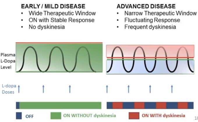 dihexa parkinson's Dyskinesia